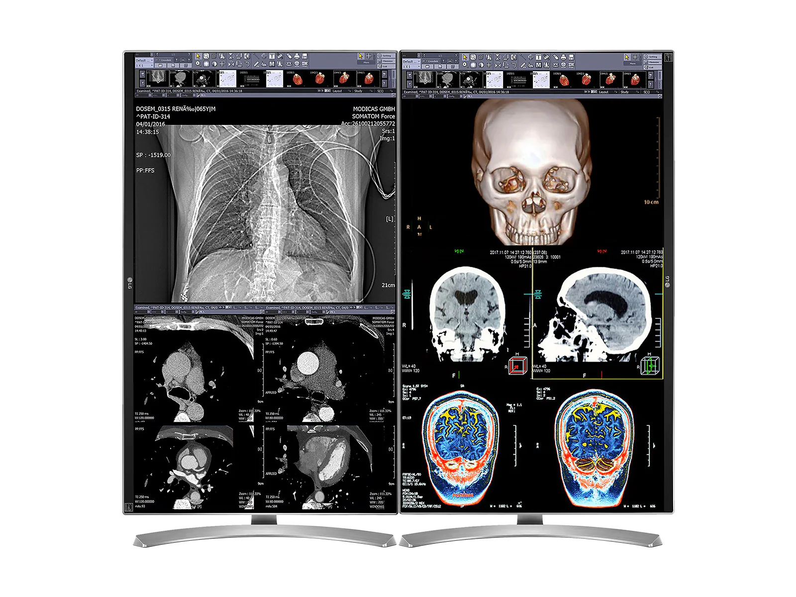 Complete Clinical Review Reading Station | 2 x LG 27M-W 27" 8MP Color Clinical Review Displays | HP ZBook Studio 16 G9 | Dictation Mic | PerfectLUM Calibration Package (LGHP16G9) - Image 4