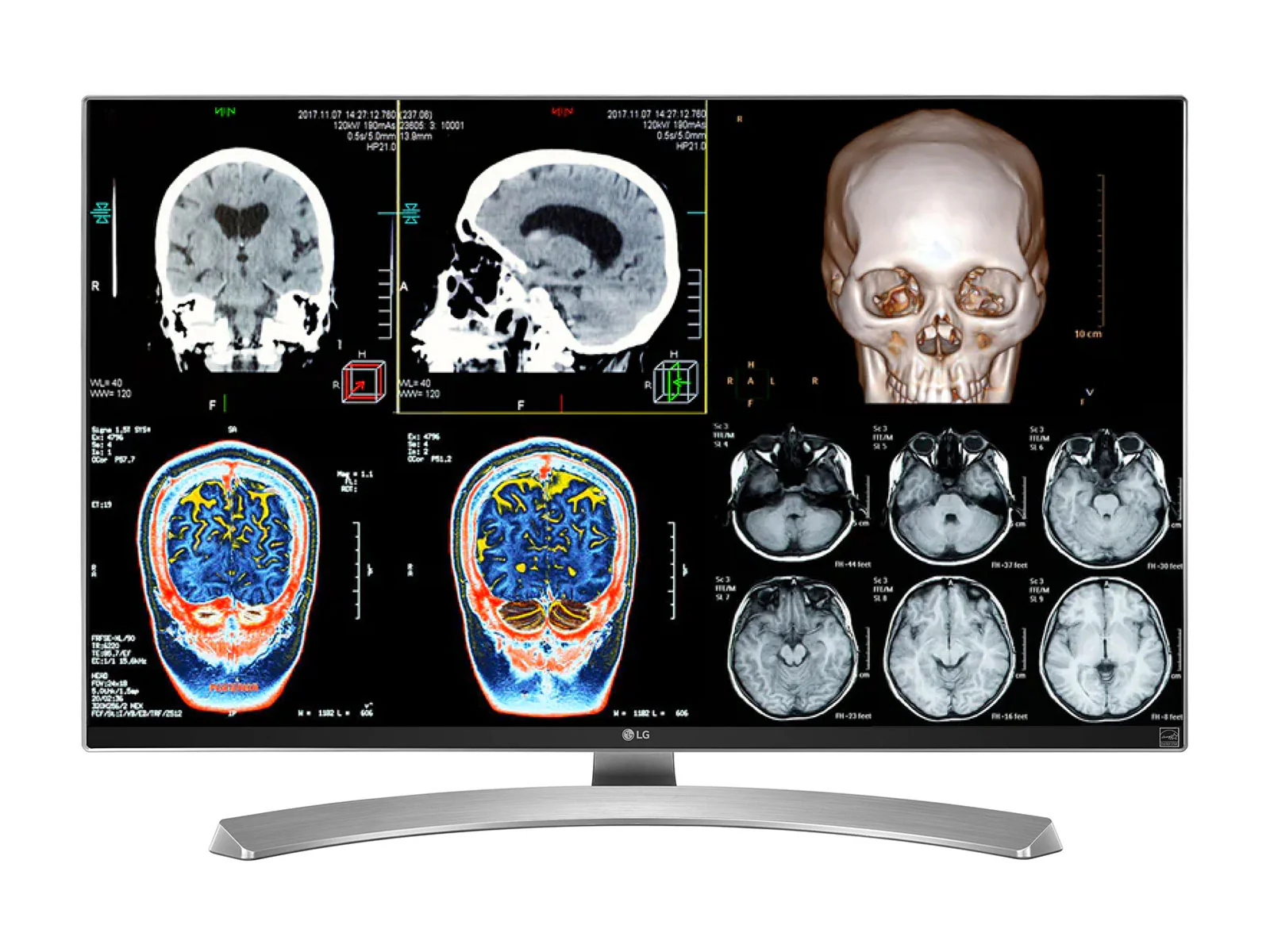 Complete Clinical Review Reading Station | 2 x LG 27M-W 27" 8MP Color Clinical Review Displays | HP ZBook Studio 16 G9 | Dictation Mic | PerfectLUM Calibration Package (LGHP16G9) - Image 5