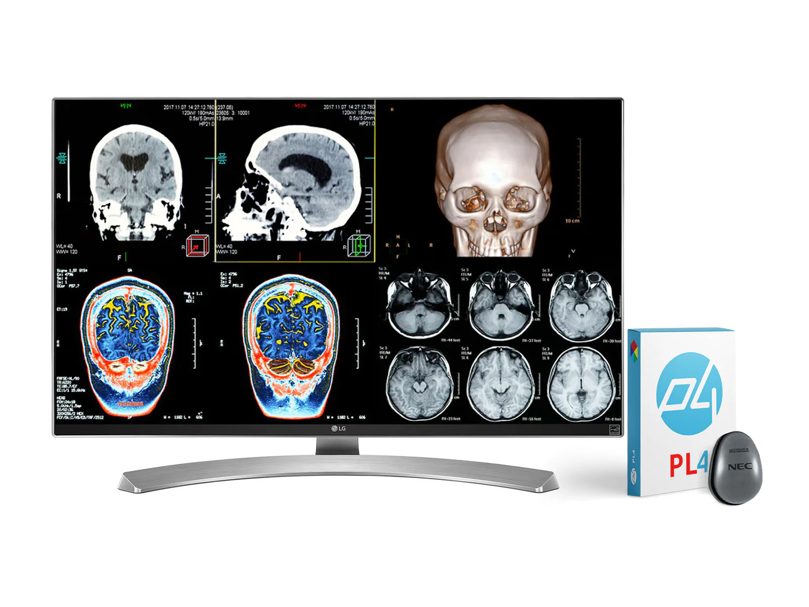Complete Clinical Review Reading Station | 2 x LG 27M-W 27" 8MP Color Clinical Review Displays | HP ZBook Studio 16 G9 | Dictation Mic | PerfectLUM Calibration Package (LGHP16G9) - Image 6