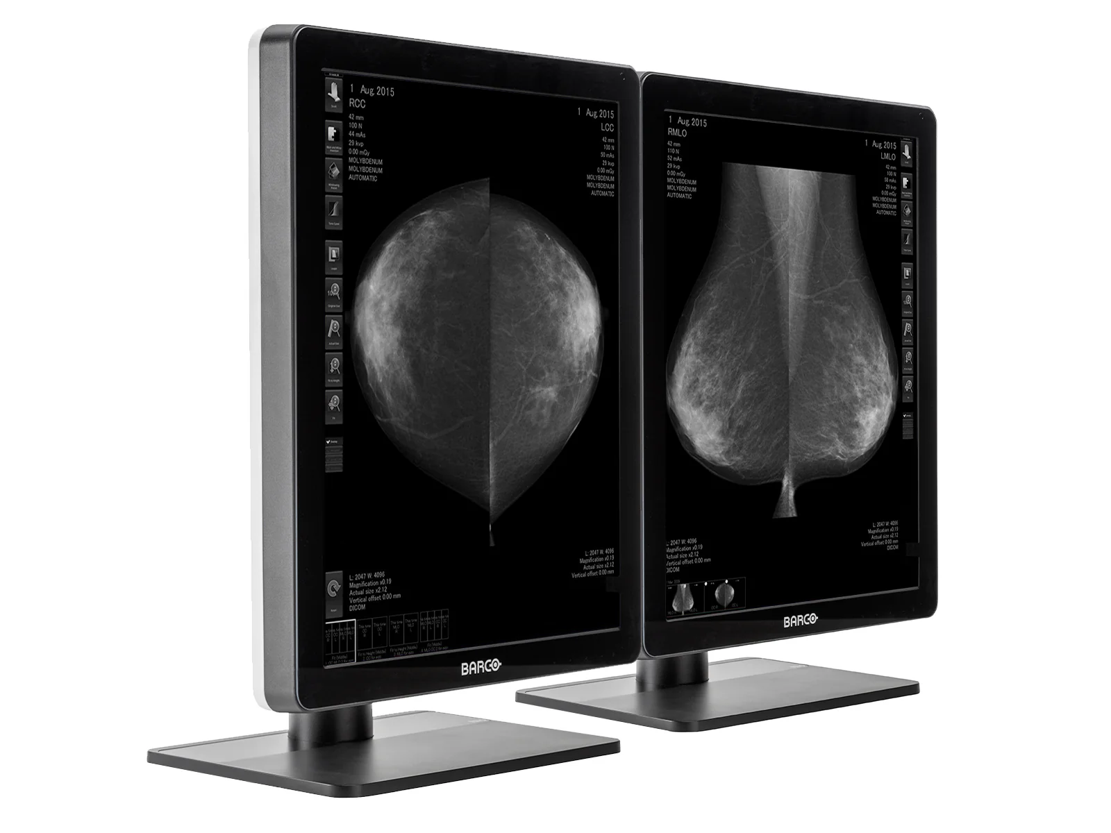 Complete Mammography Reading Station | Barco MDNG-5221 5MP Grayscale LED Monitors | HP Workstation | Dictation Mic | Worklist Monitors (QNG5221Z4R) - Image 3
