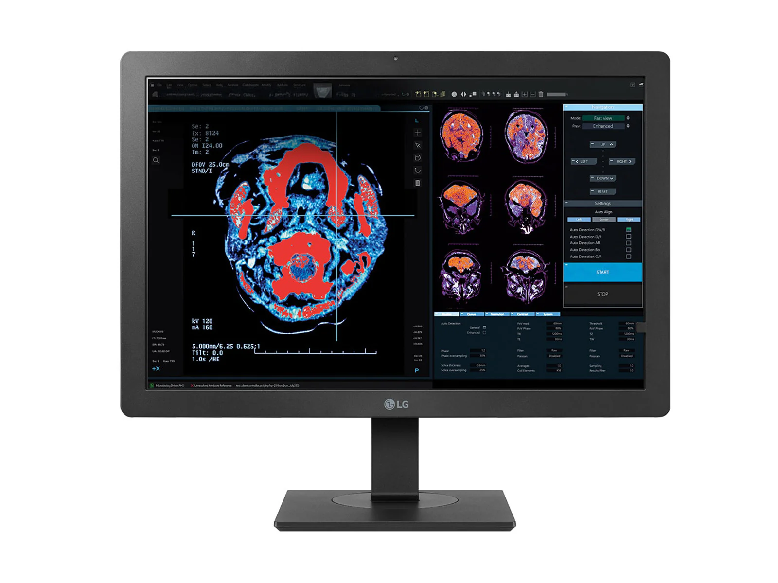 LG 2MP 24" 24HR513C-B Clinical Review Medical Display Monitor with Auto DICOM calibration