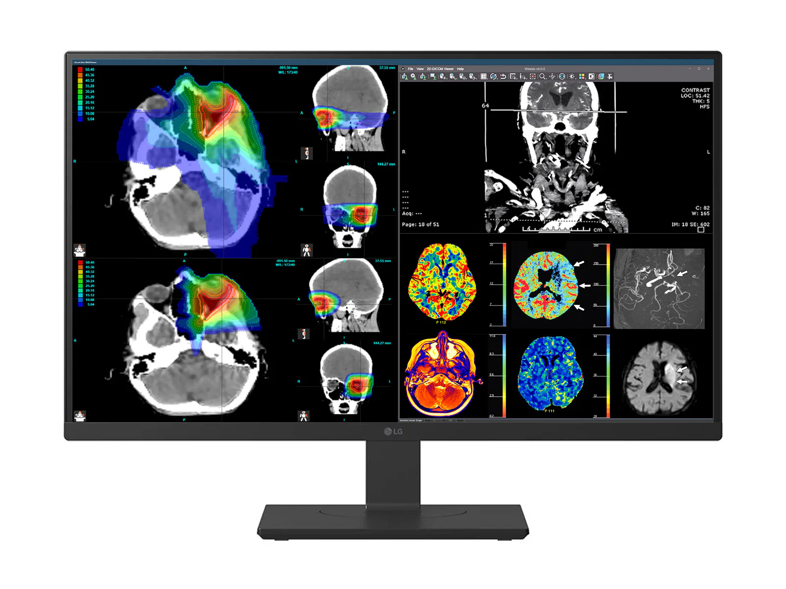 LG 27" 27HS713C Fusion 8MP 4K Clinical Review Medical DICOM Display Monitor