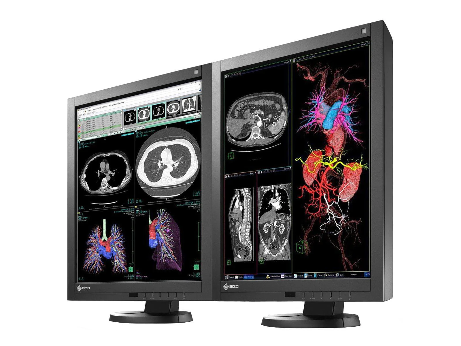 Complete PACS General Radiology Station | Eizo Radiforce RX340 3MP Color LED Displays | Lenovo Workstation | Dictation Mic | Worklist Monitor (RX340Z4R) - Image 3