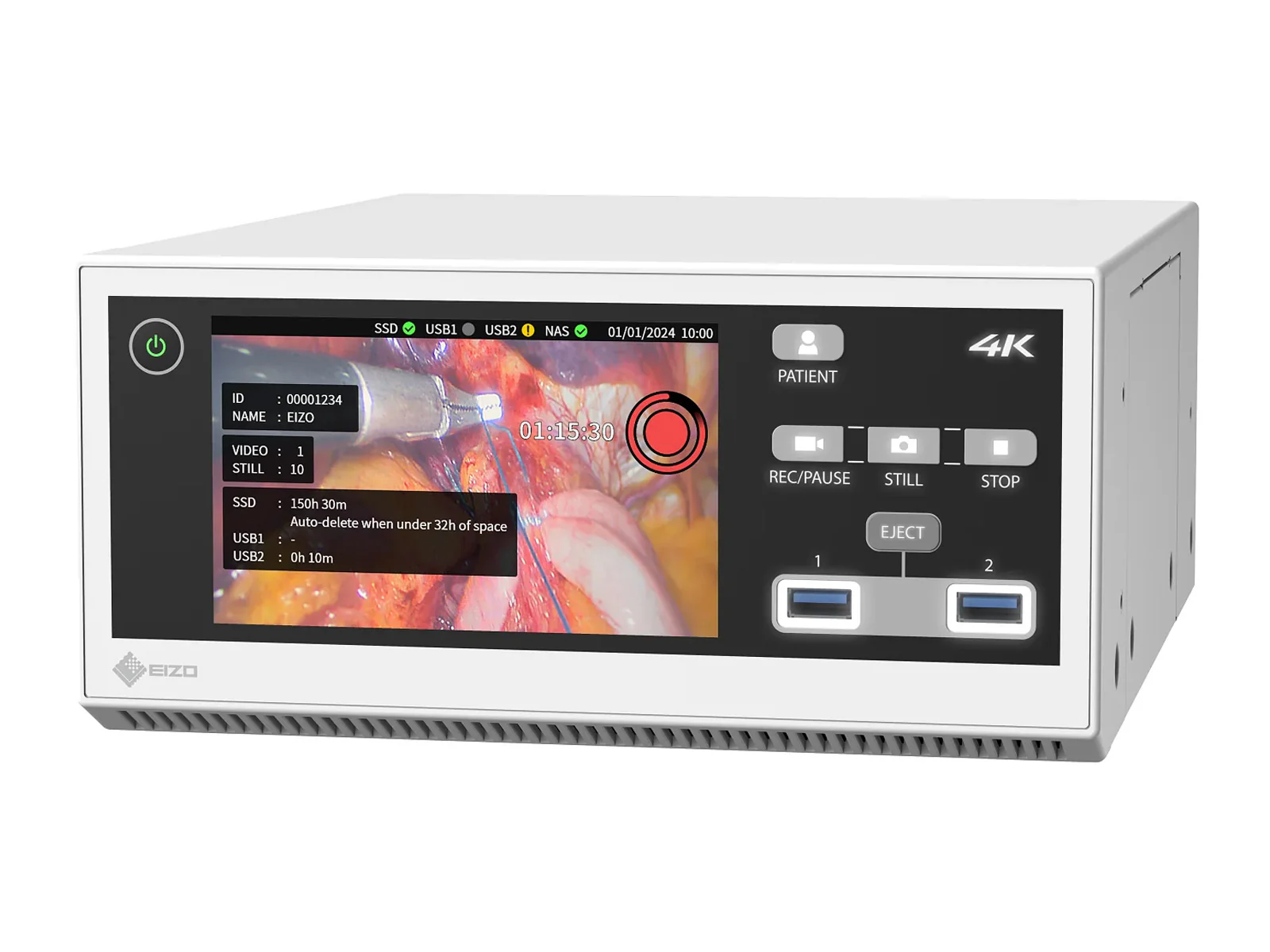 Eizo CuratOR MIR-1 4K/60p Recorder for Medical Images (MIR-1) - Image 2