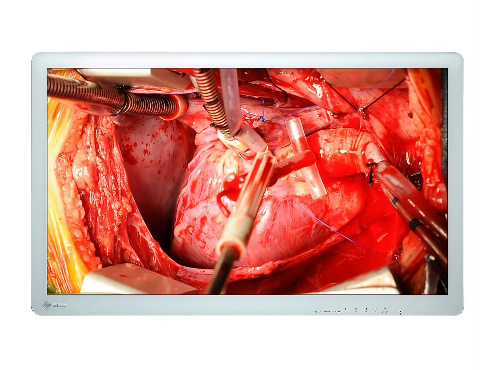 Eizo 26" FHD Surgical Endoscopy Medical LCD Display Monitor (EX2621)