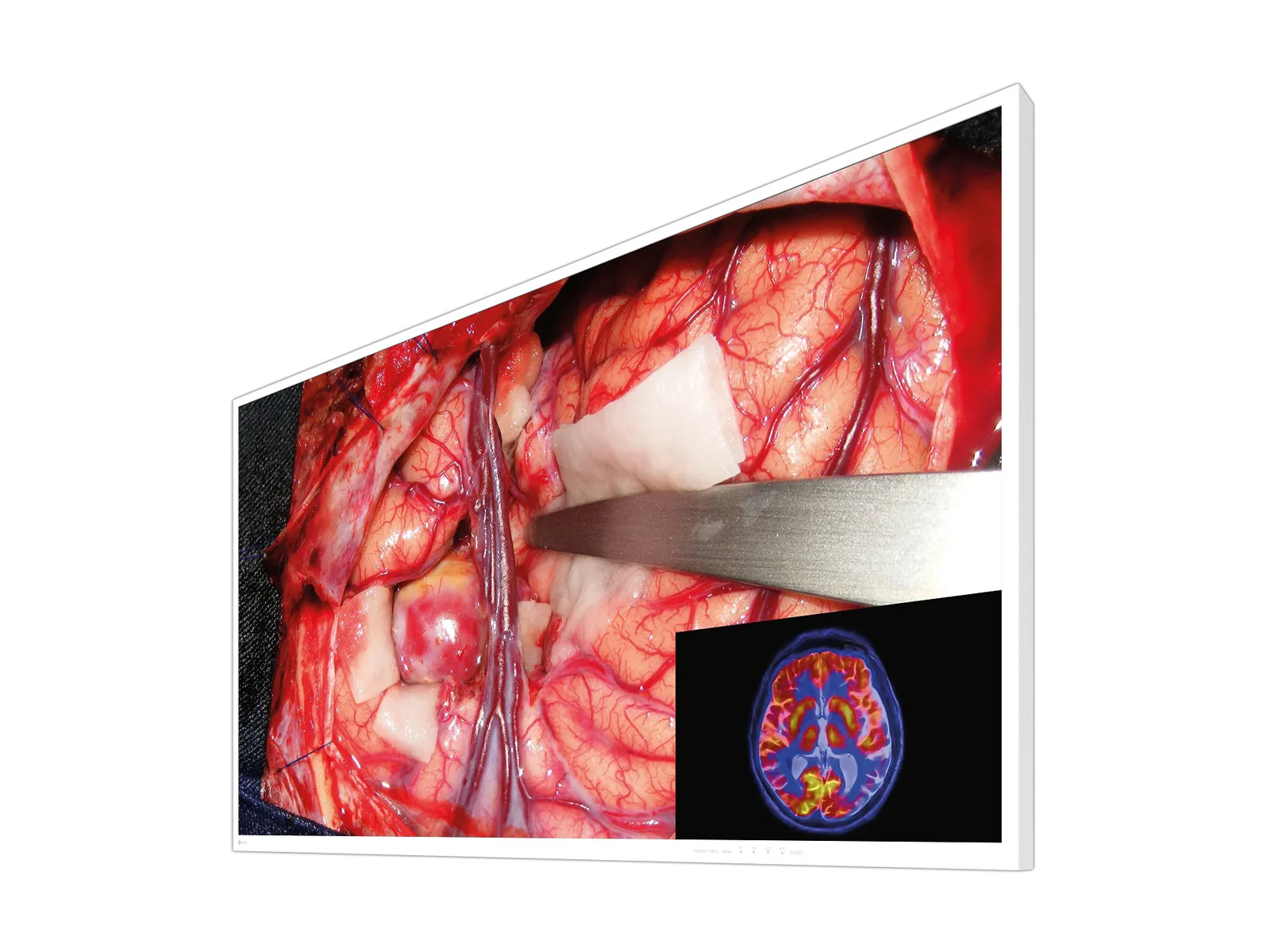 Eizo CuratOR 55" 4K UHD Surgical Medical Display Monitor (EX5542) - Image 2