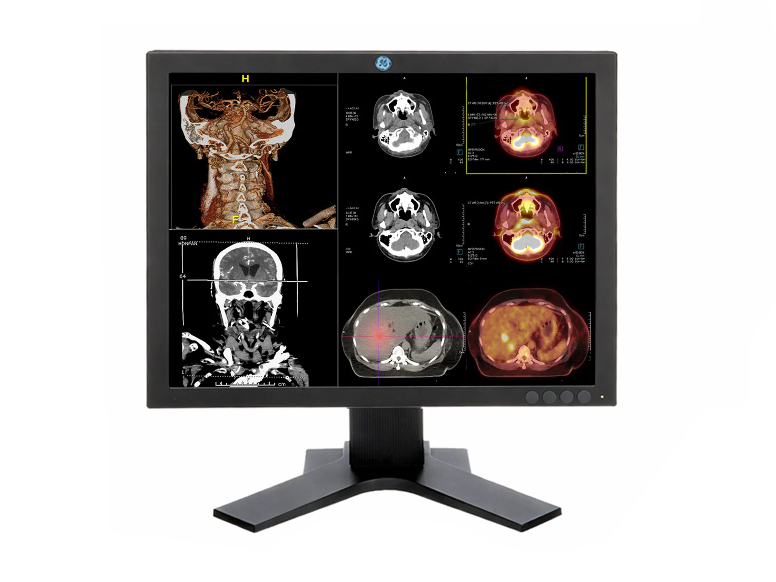 Eizo GE RS150-S Color Clinical Review Display Monitor