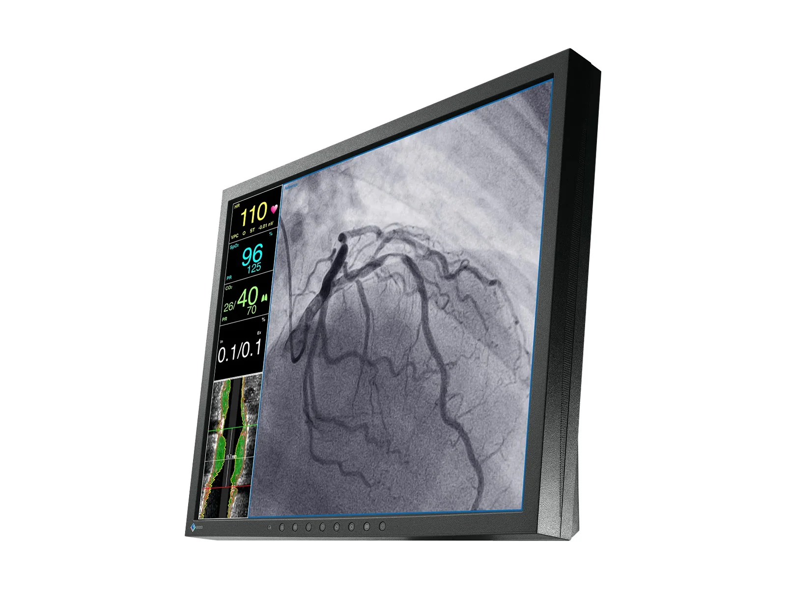 Eizo CuratOR 19" SXGA Surgical Endoscopy Medical LCD Display Monitor (LX1910-S) - Image 2