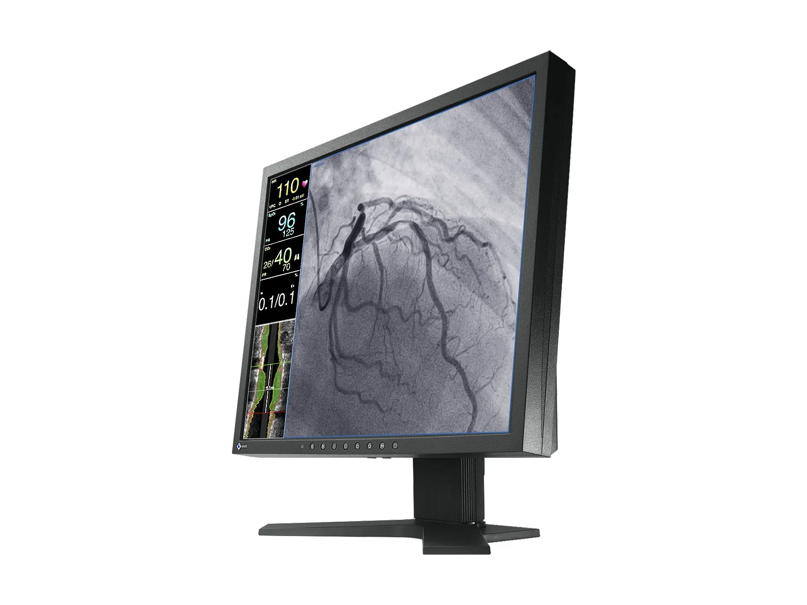 Eizo CuratOR 19" SXGA Surgical Endoscopy Medical LCD Display Monitor (LX1910-S) - Image 3