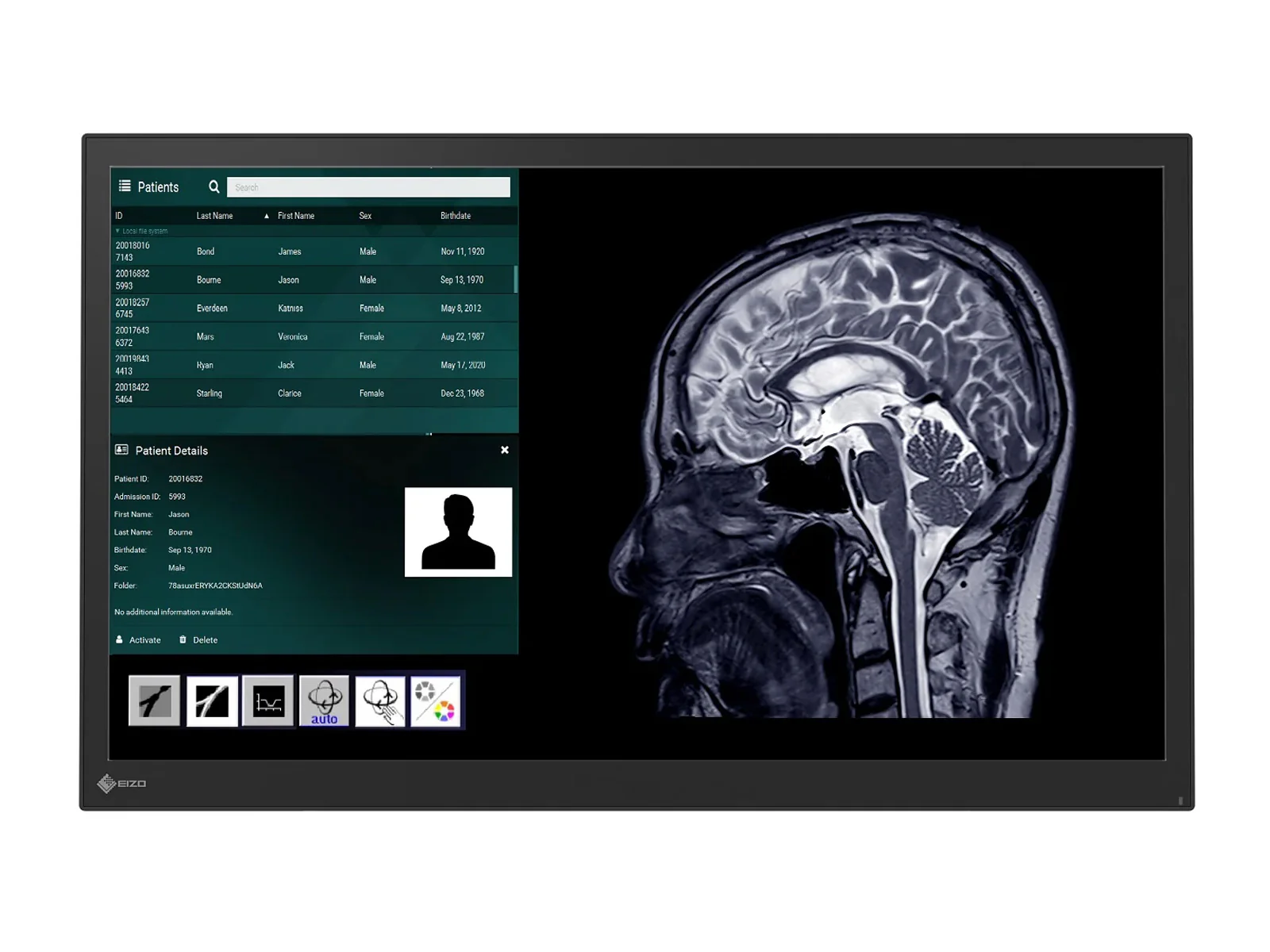 Eizo CuratOR LX2420-T 24" Surgical Touchscreen Monitor (LX2420-T) - Image 4