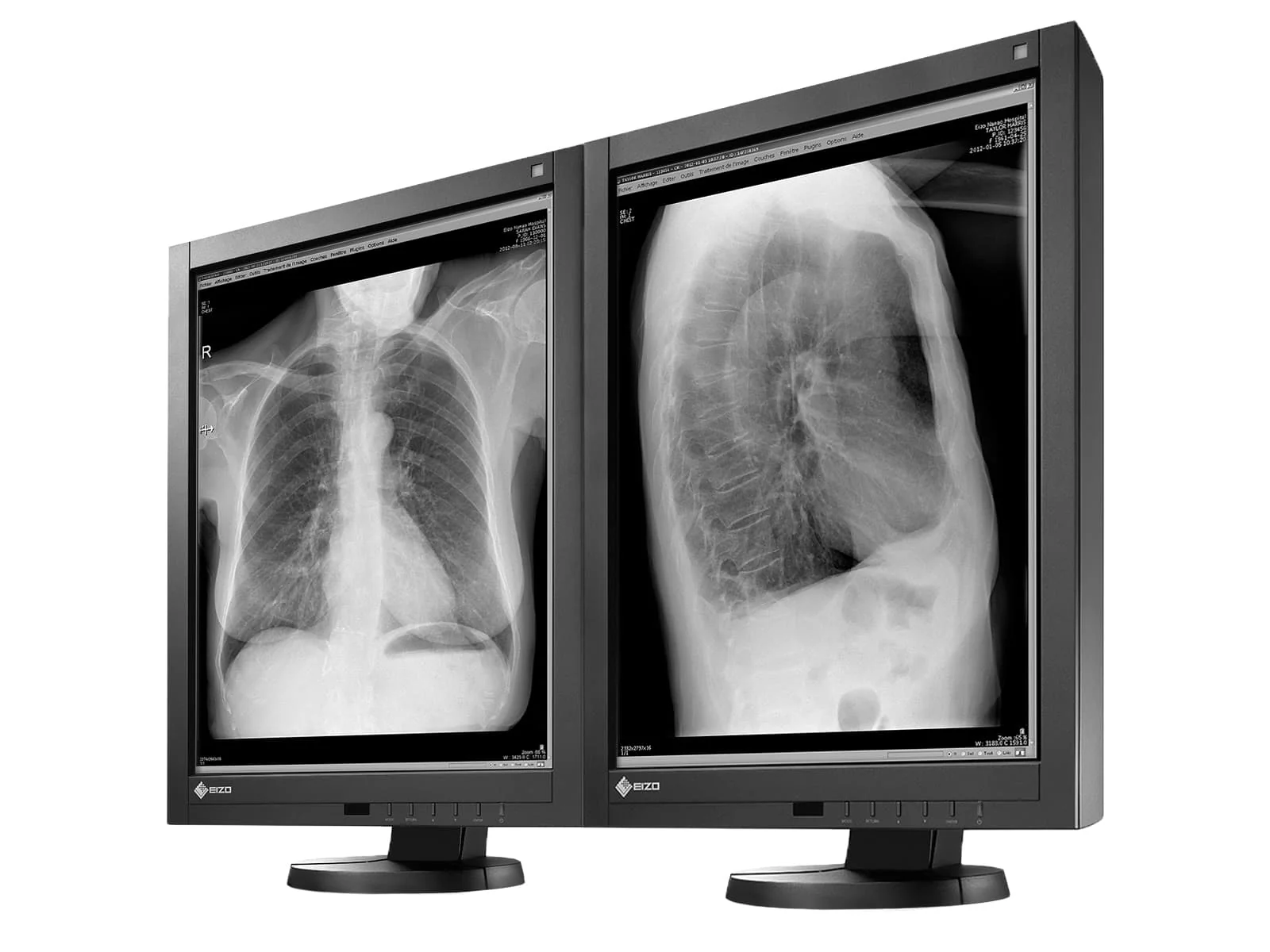 Eizo Radiforce GX240 21" 2MP Grayscale PACS Display Monitor (GX240) - Image 2