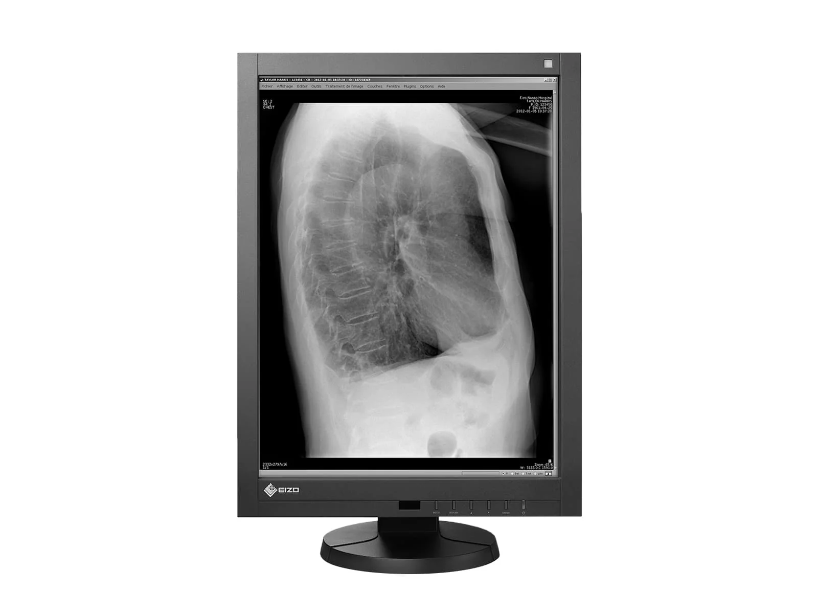 Eizo Radiforce GX240 21" 2MP Grayscale PACS Display Monitor (GX240) - Image 3