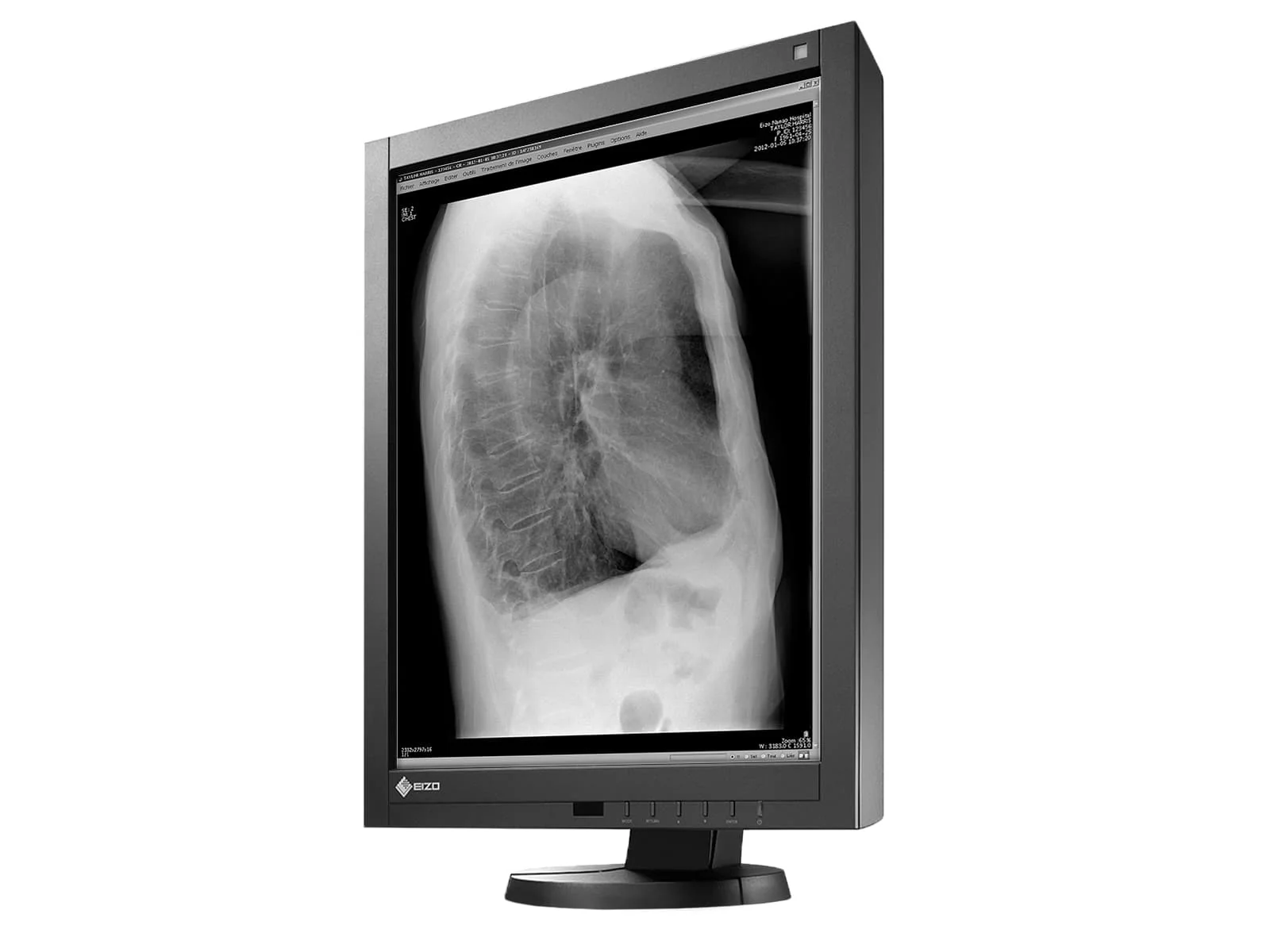 Eizo Radiforce GX240 21" 2MP Grayscale PACS Display Monitor (GX240) - Image 4
