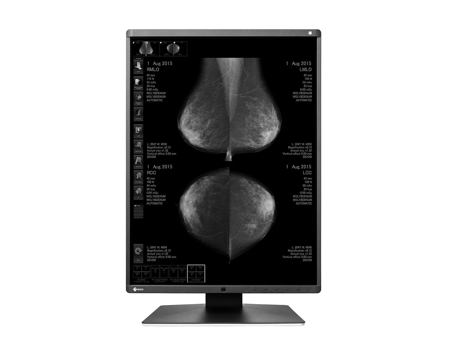 Eizo RadiForce GX550 5MP 21" Grayscale Mammo 3D-DBT Breast Imaging Display (GX550-BK) - Image 4