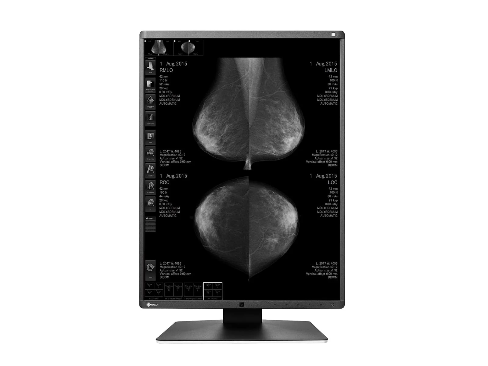 Eizo RadiForce GX560 5MP 21" Grayscale Mammo 3D-DBT Breast Imaging Display Monitor (GX560-MD) - Image 4