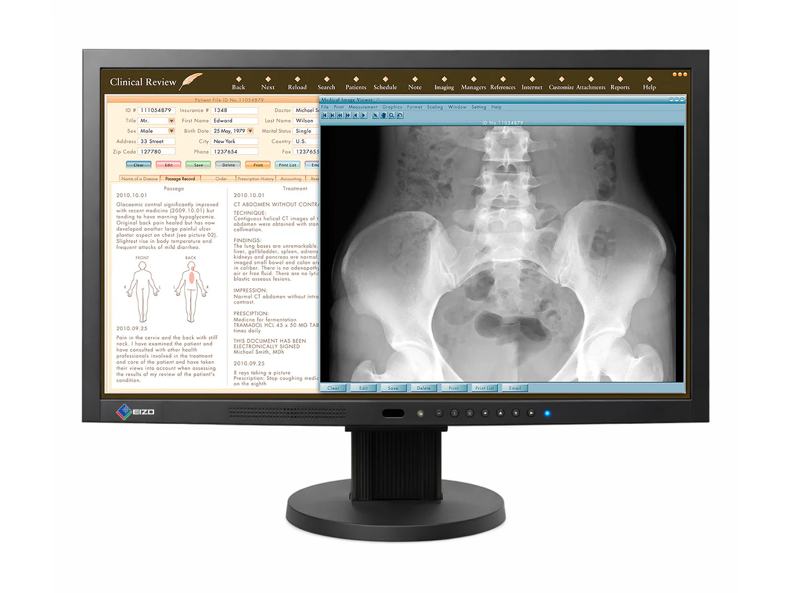 Eizo RadiForce MS230W 2MP 23" Color Clinical Review Medical Display Monitor (MS230WUKBKB)