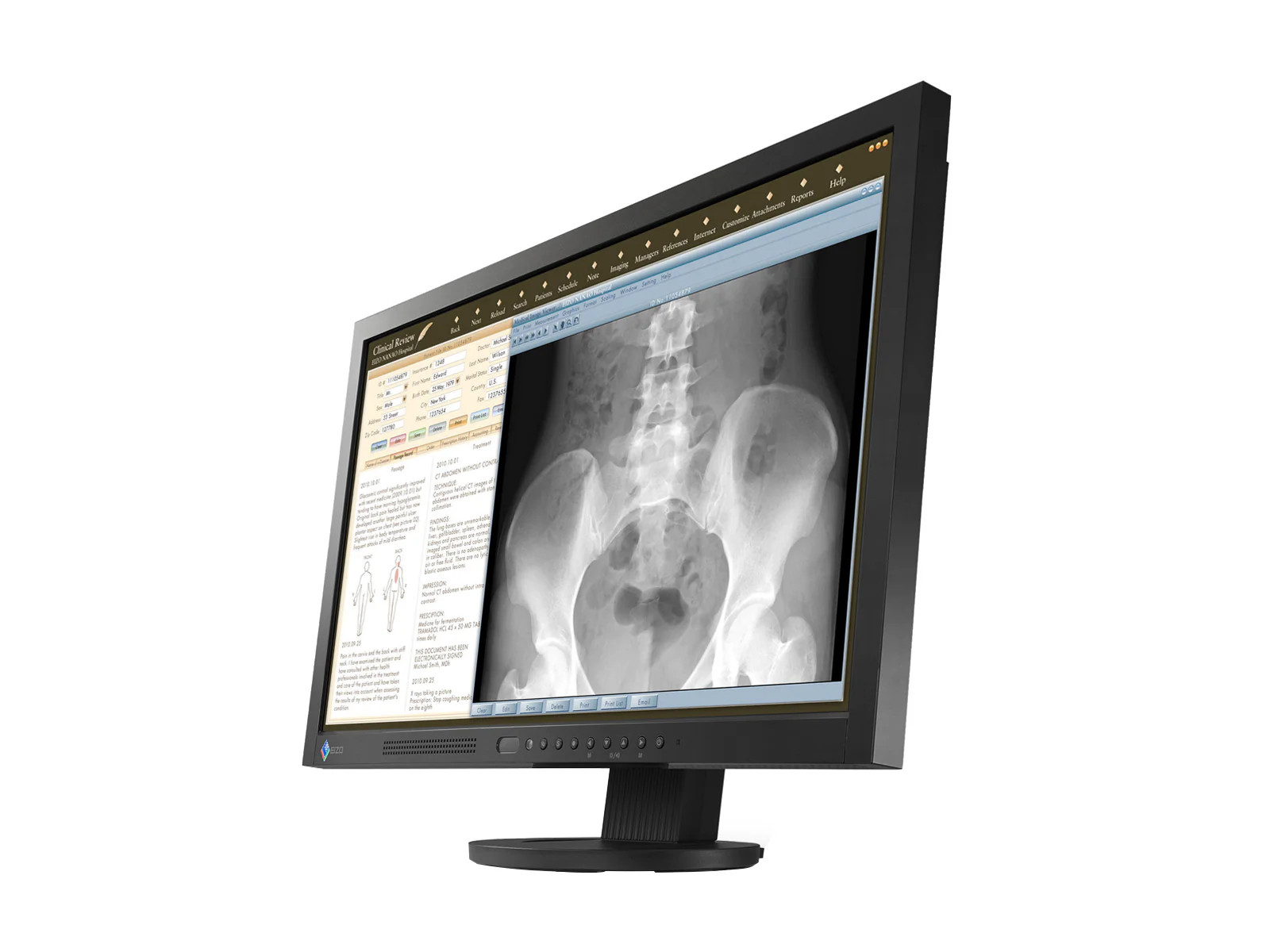 Eizo RadiForce MS230W 2MP 23" Color Clinical Review Medical Display Monitor (MS230WUKBKB) - Image 2