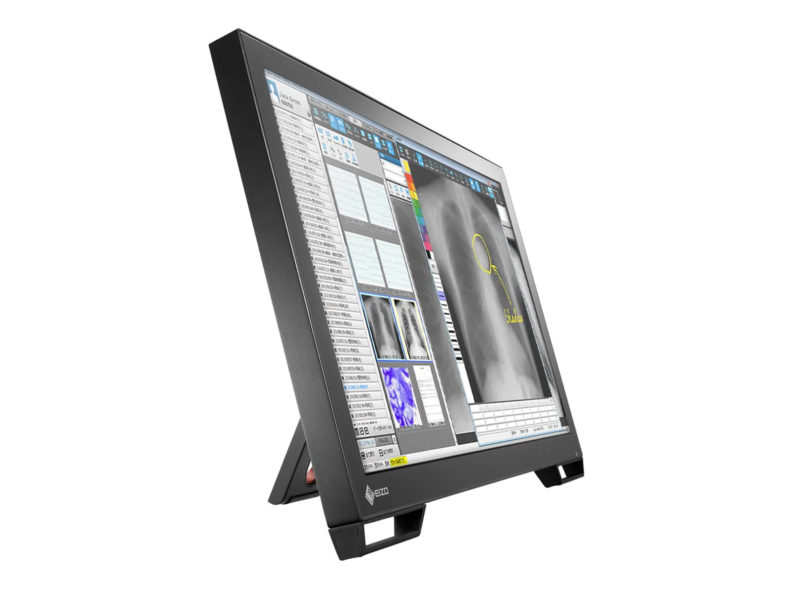 Eizo Radiforce MS236WT 2MP 23" Multi-Touch Color Clinical Review Dental Monitor with Stylus Pen (MS236WT) - Image 2