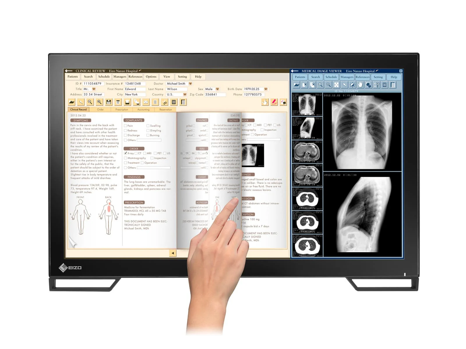 Eizo Radiforce MS236WT 2MP 23" Multi-Touch Color Clinical Review Dental Monitor with Stylus Pen (MS236WT) - Image 6