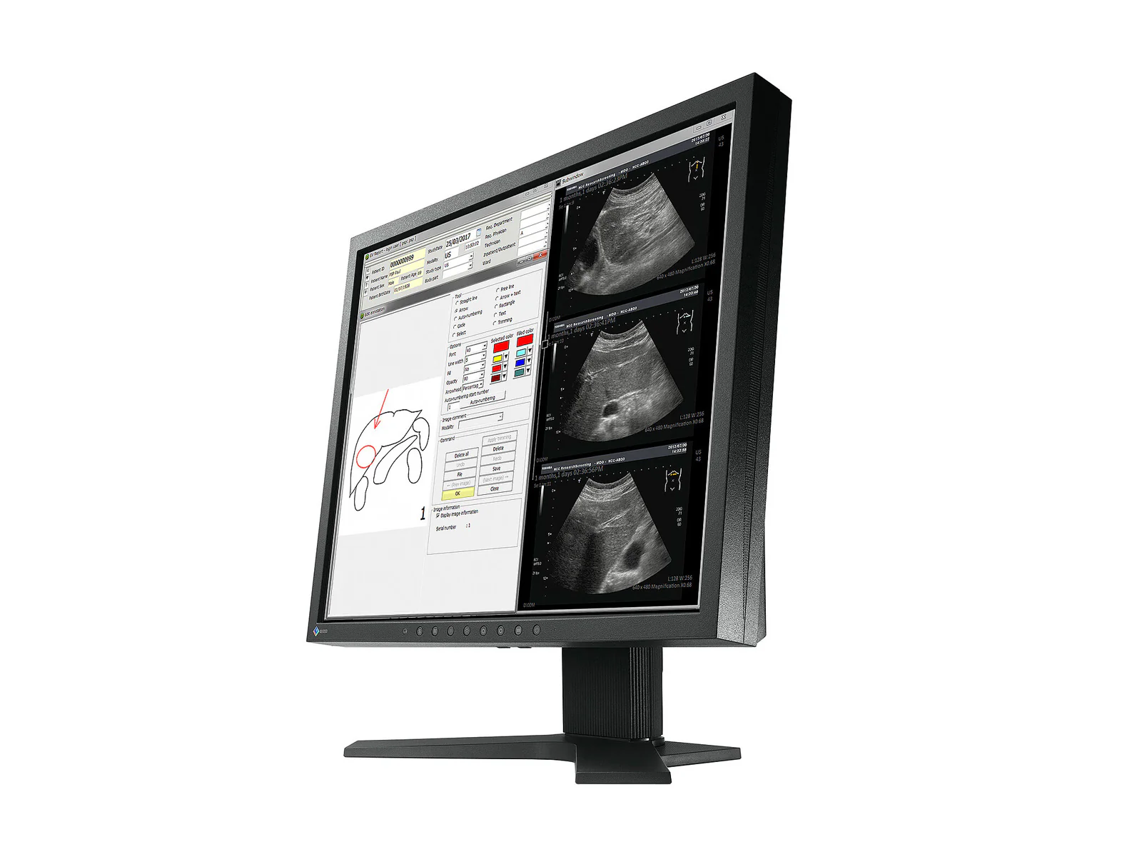 Eizo Radiforce MX194 1MP 19" Clinical Review Monitor (MX194) - Image 3