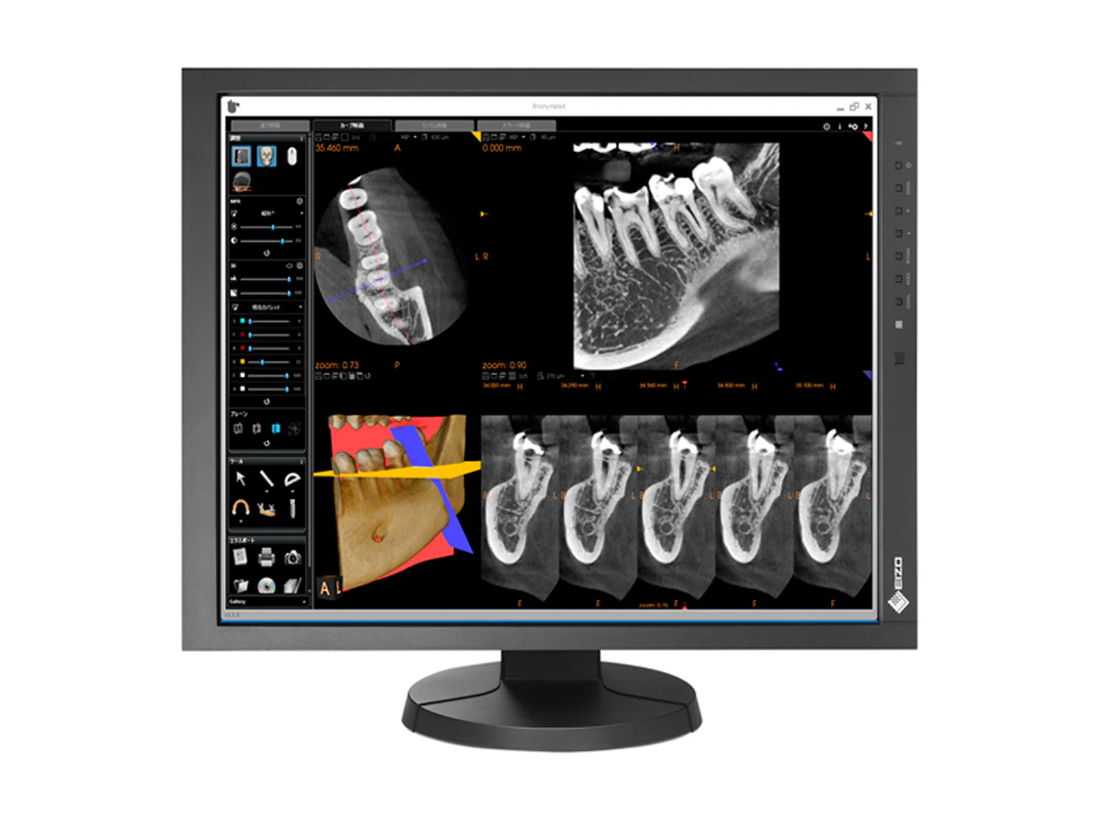 Eizo RadiForce MX215 2MP 21" Color Clinical Review Display Monitor (MX215-BK) - Image 3