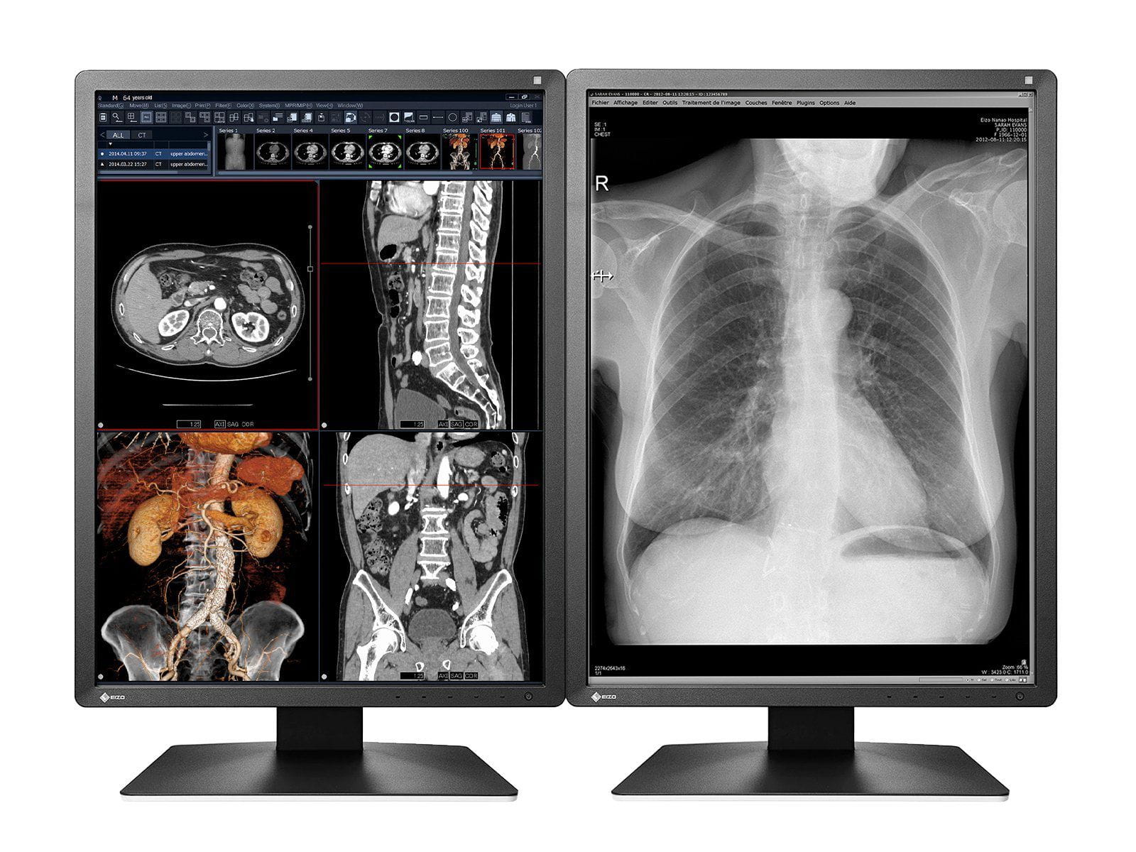 Eizo RadiForce MX216 2MP 21" Color Medical Display Monitor (MX216-BK)