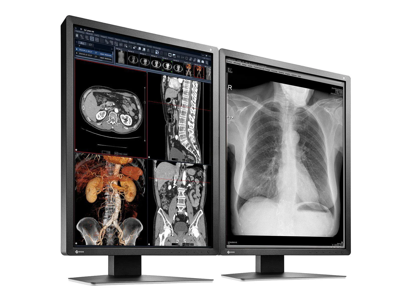 Eizo RadiForce MX216 2MP 21" Color Medical Display Monitor (MX216-BK) - Image 2