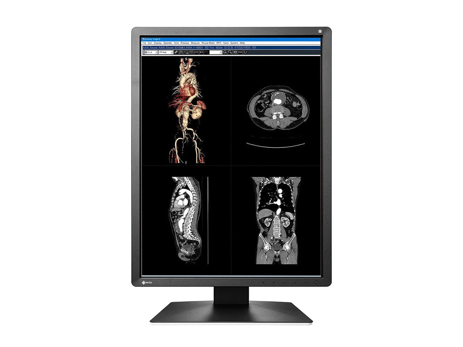 Eizo RadiForce MX216 2MP 21" Color Medical Display Monitor (MX216-BK) - Image 3