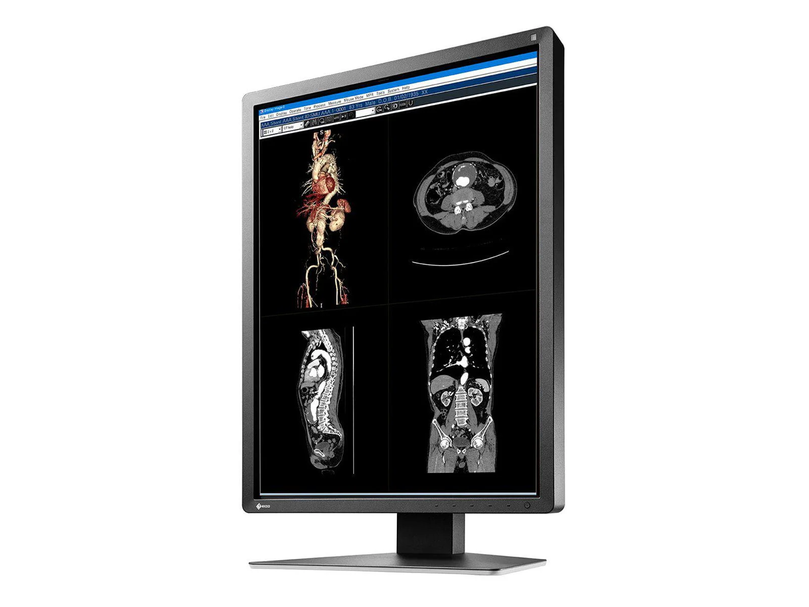 Eizo RadiForce MX216 2MP 21" Color Medical Display Monitor (MX216-BK) - Image 4