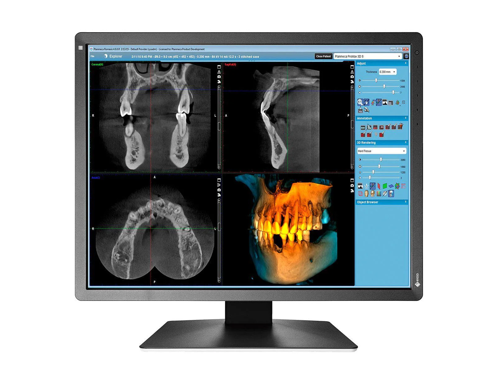 Eizo RadiForce MX216 2MP 21" Color Medical Display Monitor (MX216-BK) - Image 5