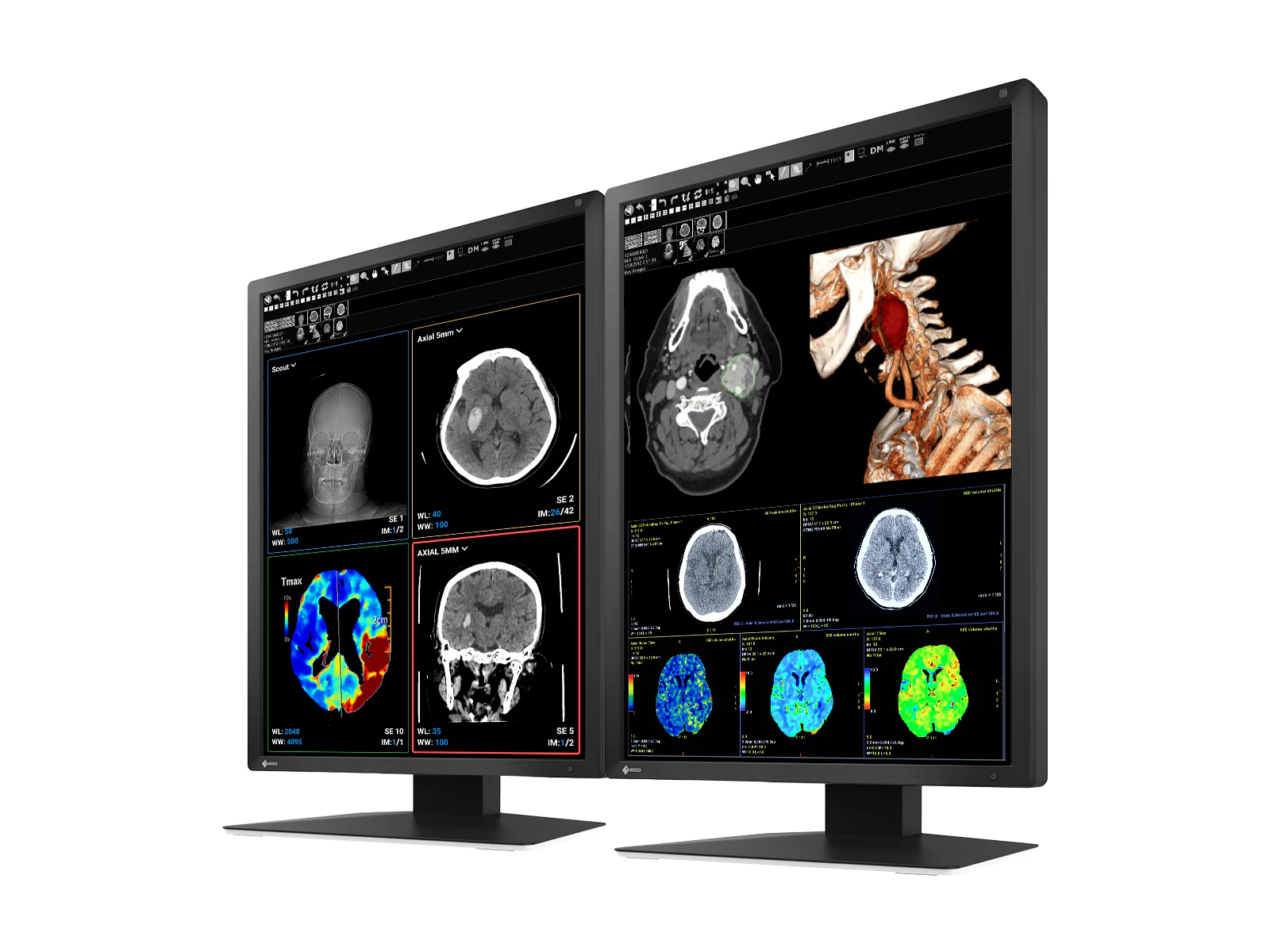 Eizo RadiForce MX217 2MP 21" Color Medical Display Monitor (MX217-BK) - Image 2