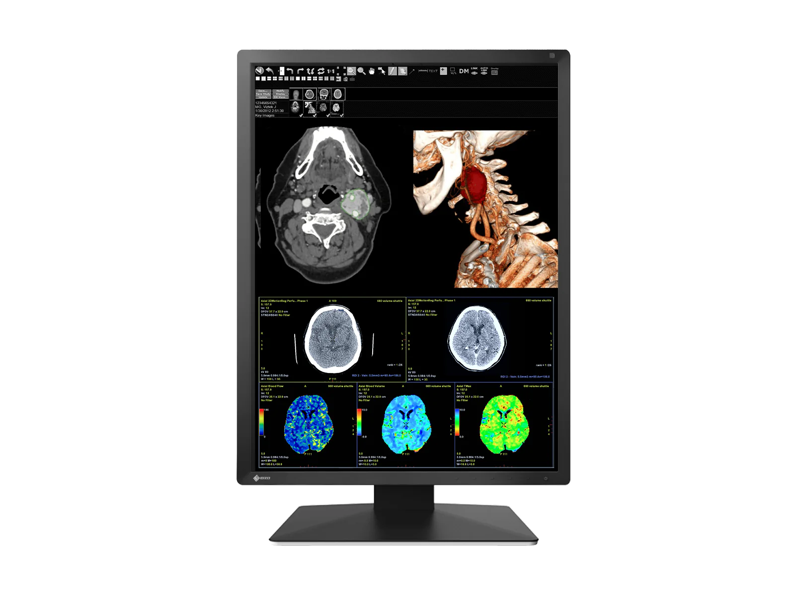 Eizo RadiForce MX217 2MP 21" Color Medical Display Monitor (MX217-BK) - Image 3