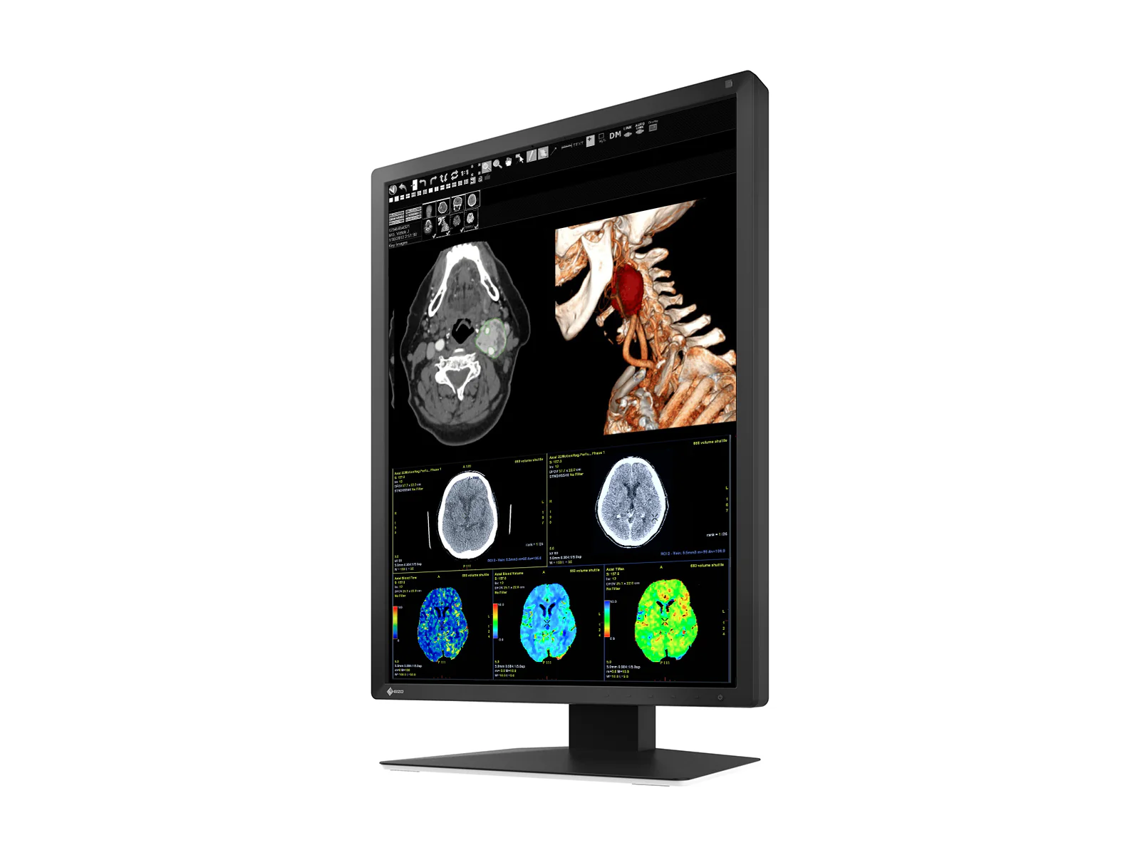 Eizo RadiForce MX217 2MP 21" Color Medical Display Monitor (MX217-BK) - Image 4