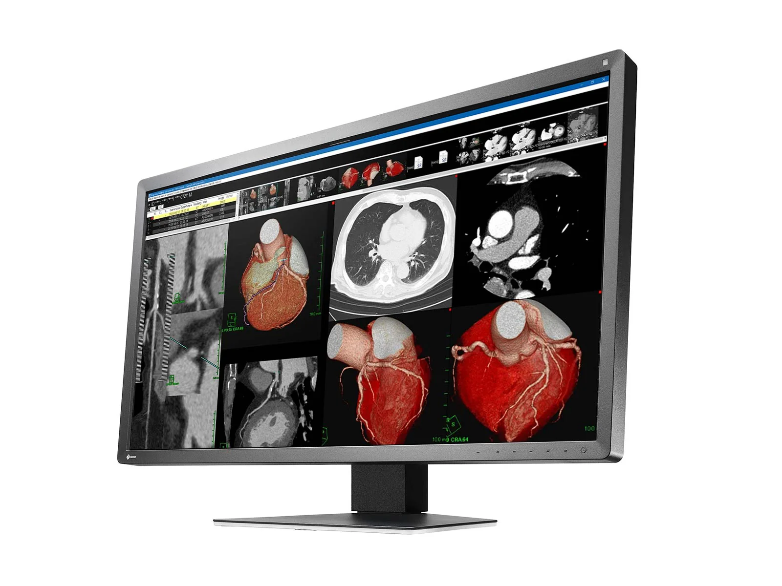 Eizo RadiForce MX317W 8MP 30" Color Clinical Review Display Monitor (MX317W-BK) - Image 3