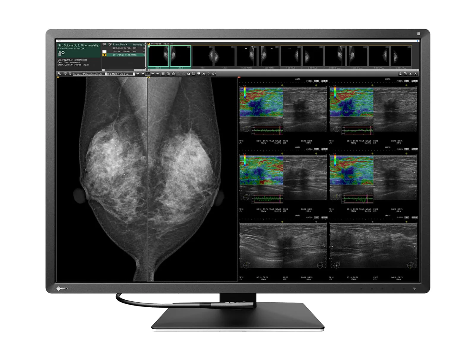 Eizo Radiforce RX1270 12MP 31" Tomo Color Mammo 3D DBT PACS Display (RX1270)
