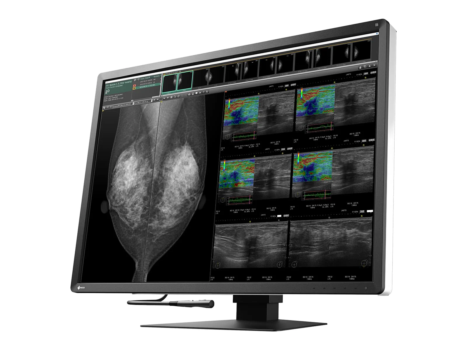 Eizo Radiforce RX1270 12MP 31" Tomo Color Mammo 3D DBT PACS Display (RX1270) - Image 2