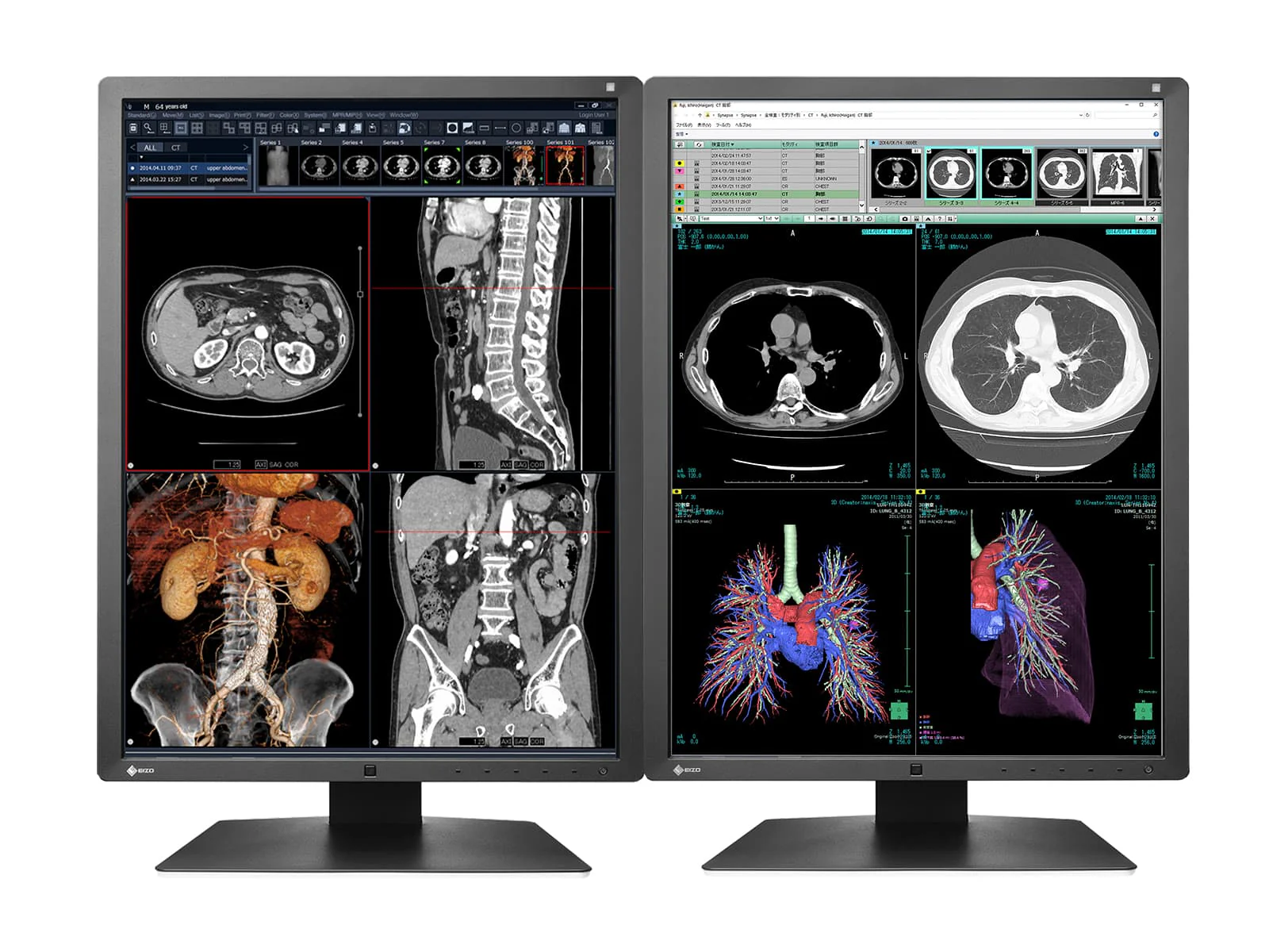 Eizo RadiForce RX250 2MP 21" Color Medical Diagnostic Radiology Display Monitor (RX250-BK)