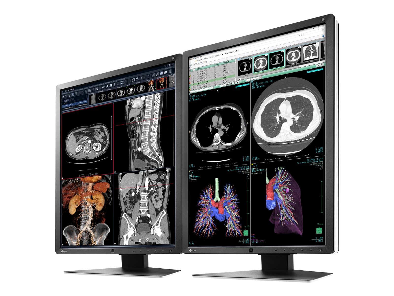 Eizo RadiForce RX250 2MP 21" Color Medical Diagnostic Radiology Display Monitor (RX250-BK) - Image 2