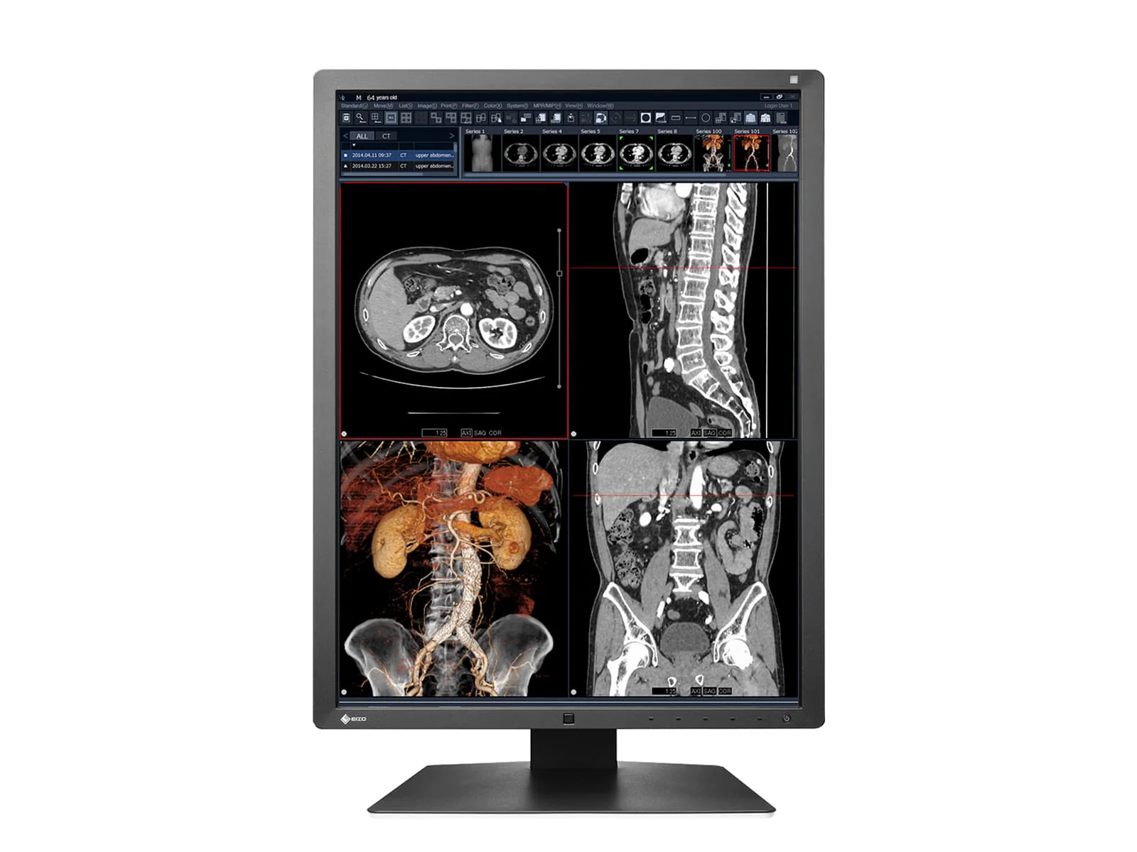 Eizo RadiForce RX250 2MP 21" Color Medical Diagnostic Radiology Display Monitor (RX250-BK) - Image 4