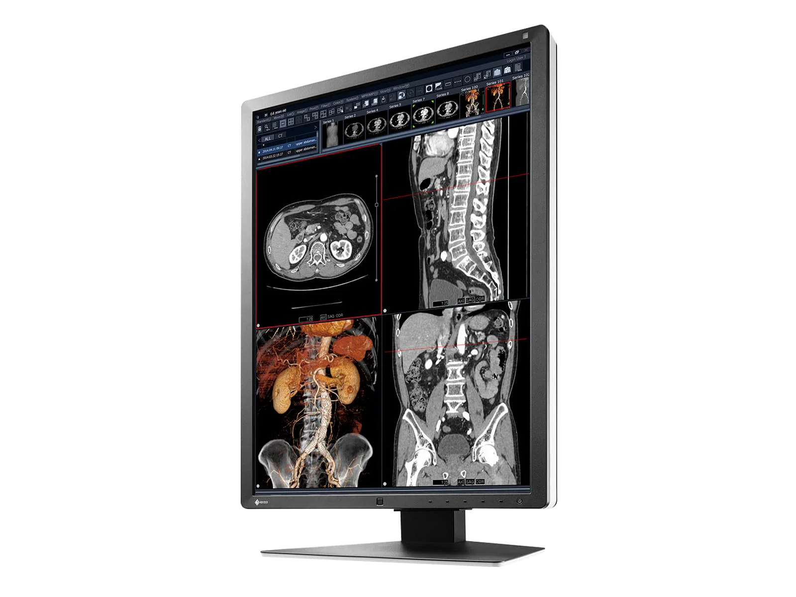 Eizo RadiForce RX250 2MP 21" Color Medical Diagnostic Radiology Display Monitor (RX250-BK) - Image 5