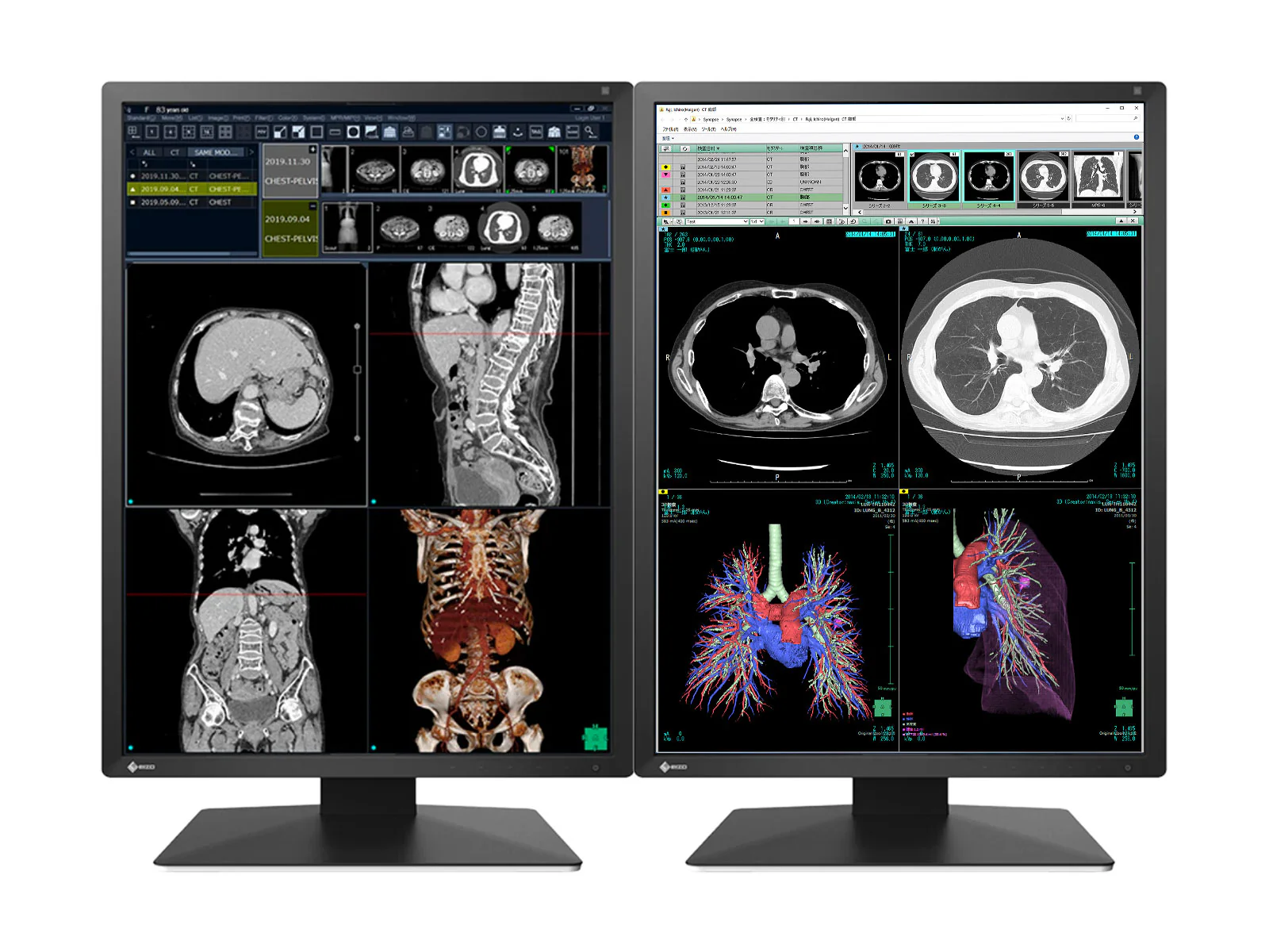 Eizo RadiForce RX270 2MP 21" Color Medical Diagnostic Radiology Display Monitor (RX270-BK)