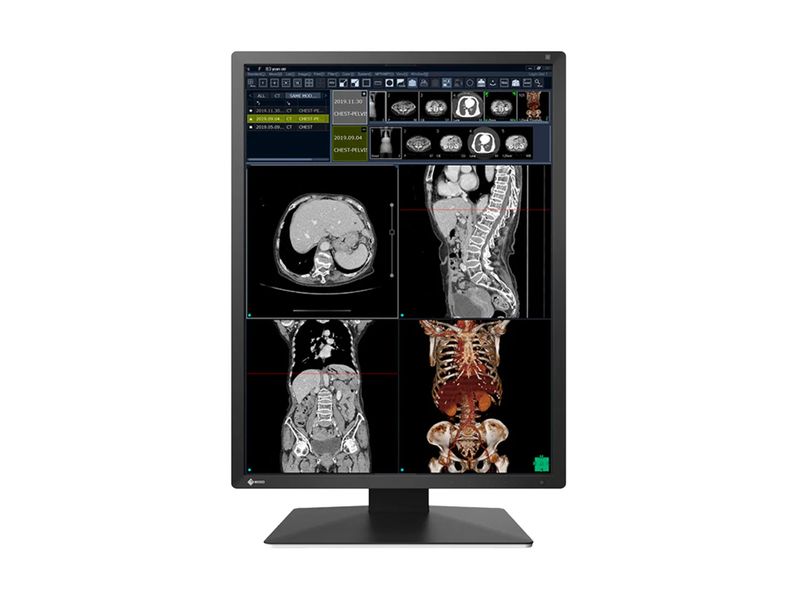 Eizo RadiForce RX270 2MP 21" Color Medical Diagnostic Radiology Display Monitor (RX270-BK) - Image 2