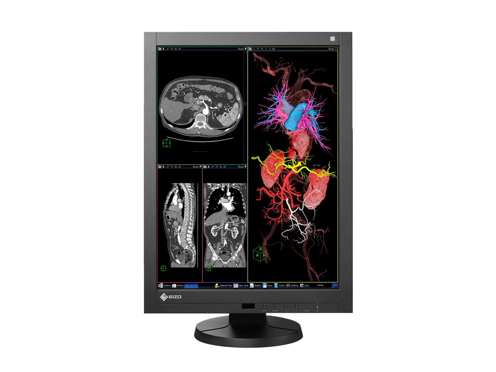 Eizo Radiforce RX340 3MP 21" Color General Radiology Diagnostic PACS Display (RX340-BK) - Image 3