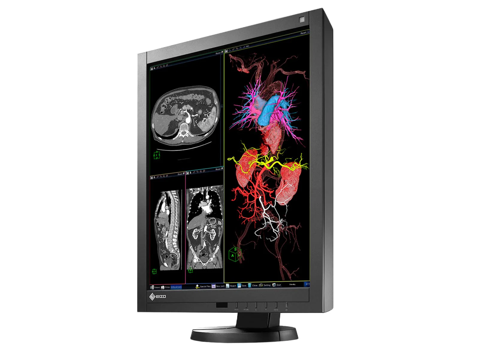 Eizo Radiforce RX340 3MP 21" Color General Radiology Diagnostic PACS Display (RX340-BK) - Image 4