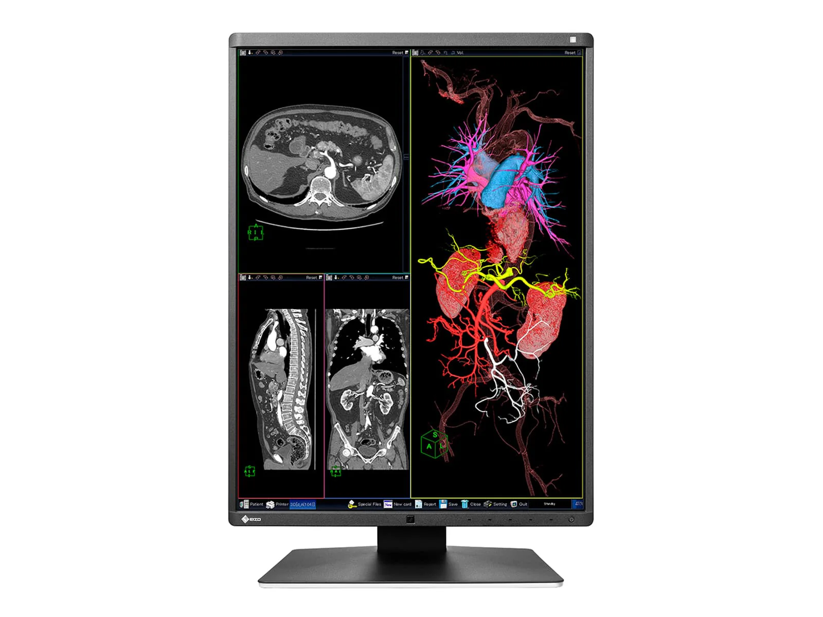 Eizo RadiForce RX350 3MP 21" Color General Radiology Diagnostic Display (RX350) - Image 4