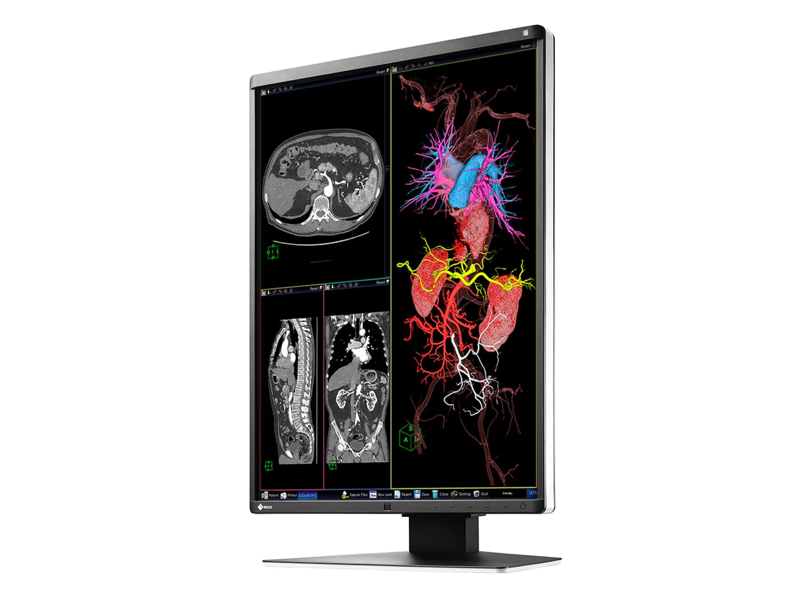 Eizo RadiForce RX350 3MP 21" Color General Radiology Diagnostic Display (RX350) - Image 5