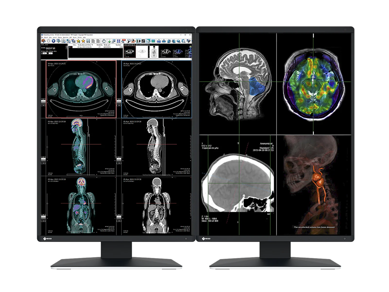 Eizo RadiForce RX370 3MP 21" Color General Radiology Diagnostic PACS Display (RX370)