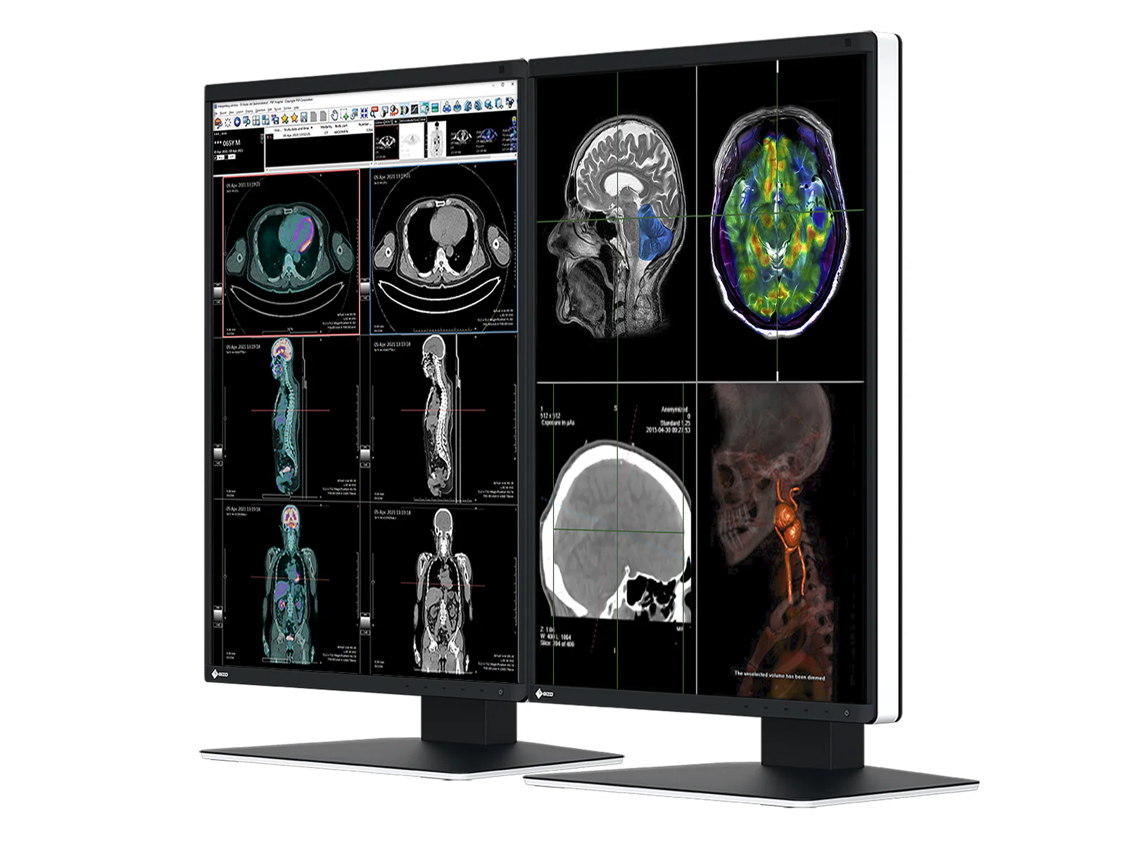 Eizo RadiForce RX370 3MP 21" Color General Radiology Diagnostic PACS Display (RX370) - Image 2