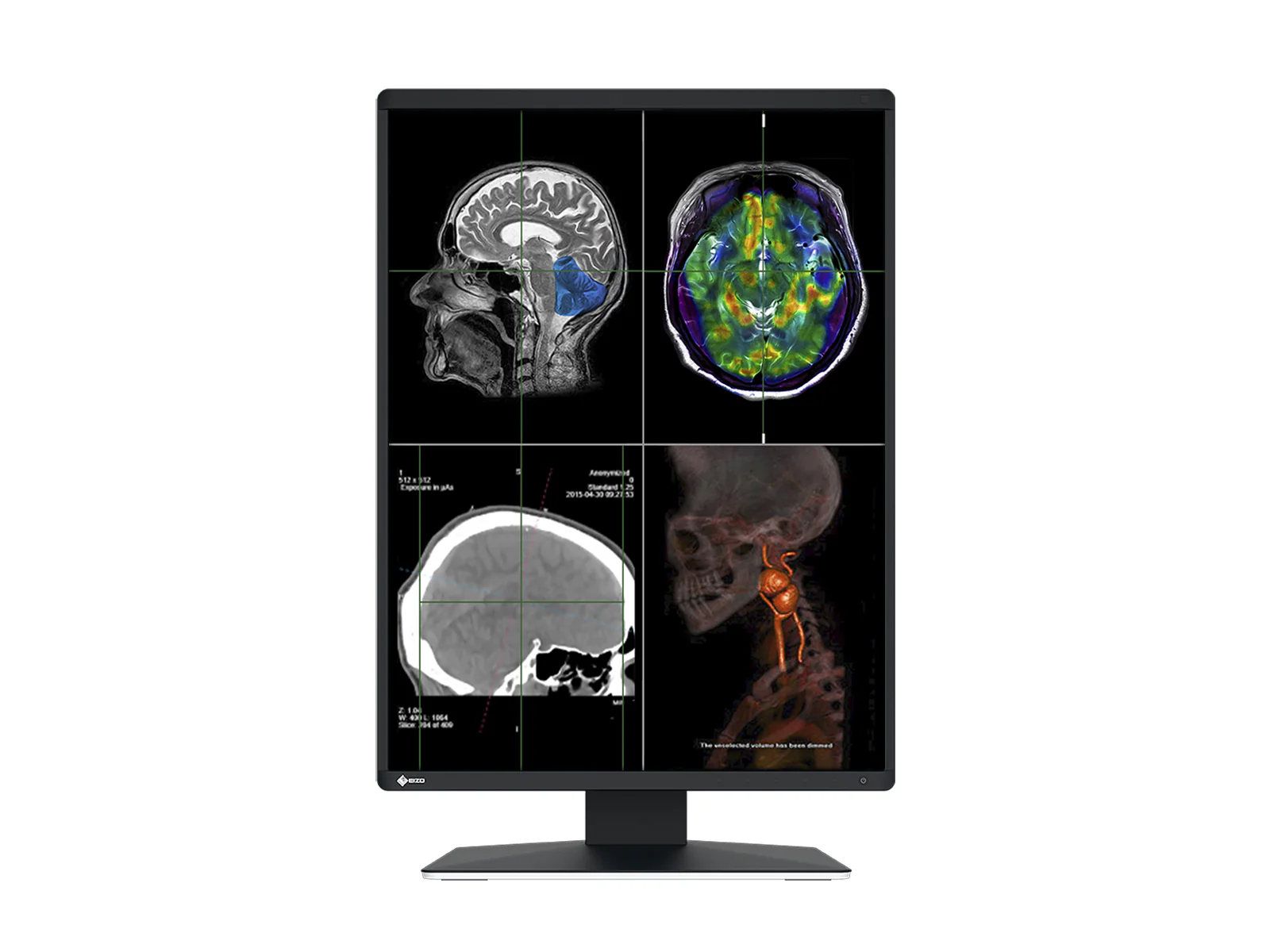 Eizo RadiForce RX370 3MP 21" Color General Radiology Diagnostic PACS Display (RX370) - Image 3