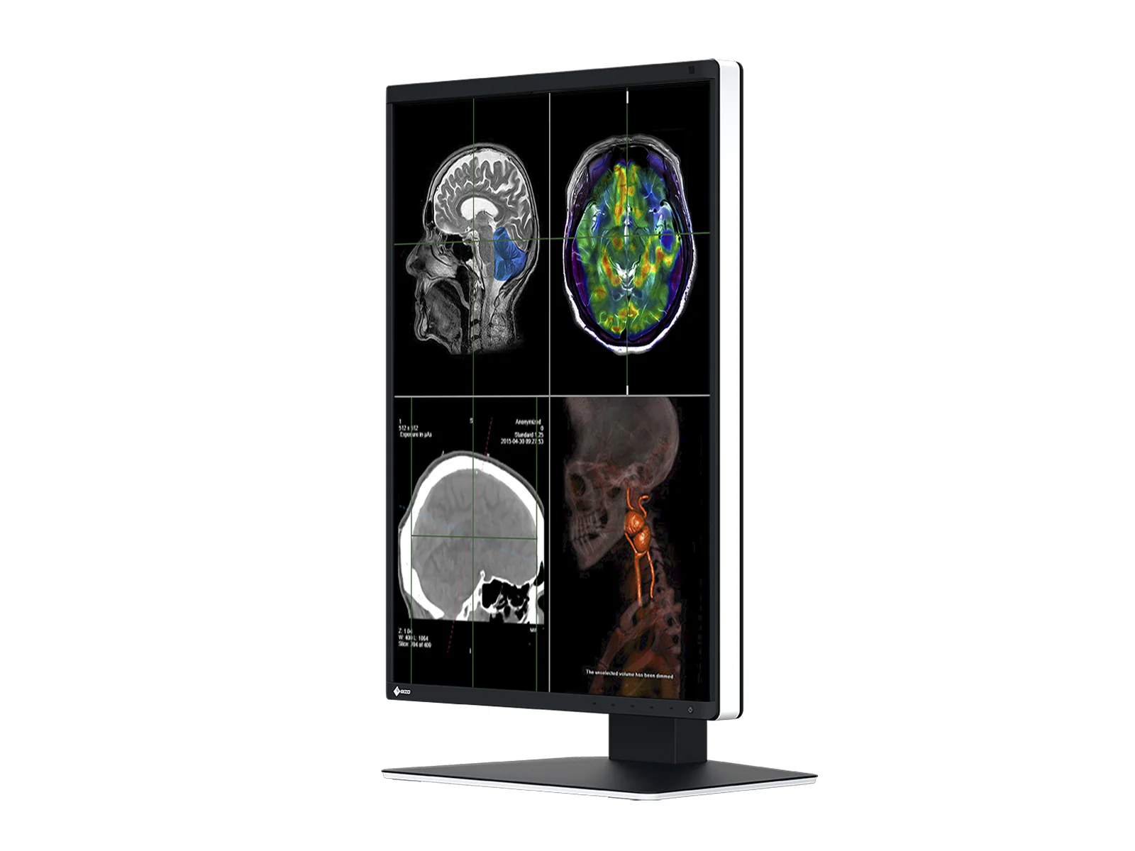 Eizo RadiForce RX370 3MP 21" Color General Radiology Diagnostic PACS Display (RX370) - Image 4